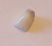 Image... Tooth